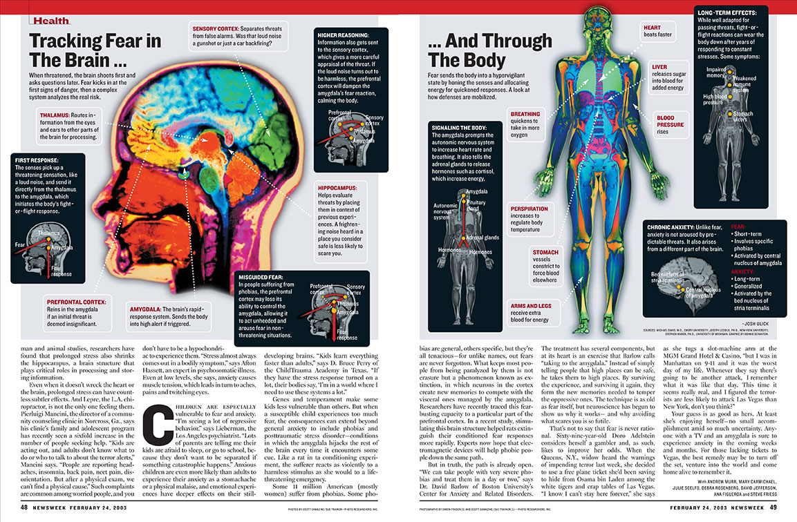 brain graphic